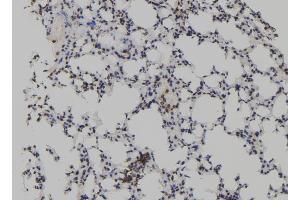 ABIN6272933 at 1/100 staining Mouse lung tissue by IHC-P. (TET2 antibody  (Internal Region))
