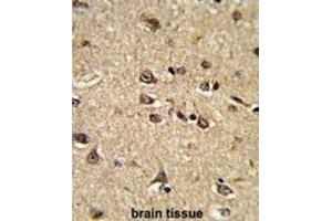 Immunohistochemistry (IHC) image for anti-Ras Interacting Protein 1 (RASIP1) antibody (ABIN3002848) (RASIP1 antibody)
