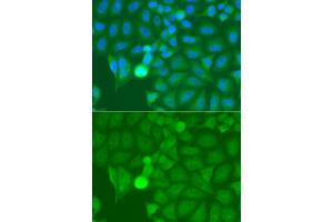 Immunofluorescence analysis of A549 cells using IRAK2 antibody. (IRAK2 antibody)