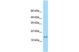 Image no. 1 for anti-Dynein Light Chain 4 (C-Term) antibody (ABIN6748345)