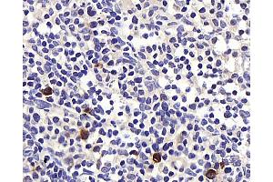 Immunohistochemistry analysis of paraffin-embedded rat lymph node using BAG2 Polyclonal Antibody at dilution of 1:400. (BAG2 antibody)