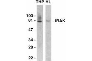 Western blot analysis of IRAK in THP-1 (THP) and HeLa (HL) whole cell lysates with AP30438PU-N IRAK antibody at 1/2000 dilution. (IRAK1 antibody  (C-Term))