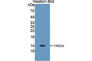 Detection of Recombinant PLOD3, Human using Polyclonal Antibody to Procollagen Lysine-2-Oxoglutarate-5-Dioxygenase 3 (PLOD3) (PLOD3 antibody  (AA 647-738))