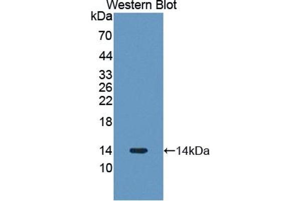 PLOD3 anticorps  (AA 647-738)