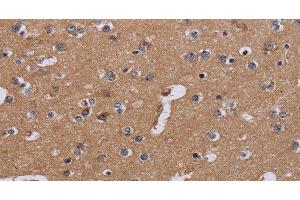 Immunohistochemistry of paraffin-embedded Human brain tissue using NDUFA1 Polyclonal Antibody at dilution 1:30 (NDUFA1 antibody)