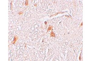 Immunohistochemical staining of human brain cells with LOC729993 polyclonal antibody  at 2. (Shisa9 antibody  (Internal Region))