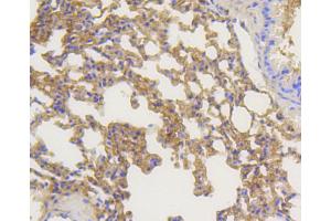 Immunohistochemistry of paraffin-embedded mouse lung using ARRB1 antibody (ABIN5996907) at dilution of 1/100 (40x lens). (beta Arrestin 1 antibody)