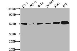Western Blot Positive WB detected in: PC-3 whole cell lysate, THP-1 whole cell lysate, Hela whole cell lysate, Jurkat whole cell lysate, K562 whole cell lysate, U87 whole cell lysate All lanes: PTPN1 antibody at 1:2000 Secondary Goat polyclonal to rabbit IgG at 1/50000 dilution Predicted band size: 50 kDa Observed band size: 50 kDa (Recombinant PTPN1 antibody)