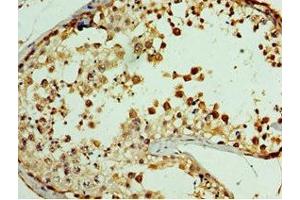 Immunohistochemistry of paraffin-embedded human testis tissue using ABIN7167823 at dilution of 1:100 (GPRC5A antibody  (AA 258-357))
