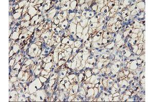 Immunohistochemistry (IHC) image for anti-Cadherin 2 (CDH2) antibody (ABIN1499626)