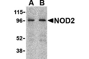 Western Blotting (WB) image for anti-Nucleotide-Binding Oligomerization Domain Containing 2 (NOD2) (C-Term) antibody (ABIN1030547) (NOD2 antibody  (C-Term))