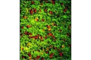 Immunofluorescence analysis of DPT Antibody (Center) with paraffin-embedded human brain tissue. (Dermatopontin antibody  (AA 102-128))