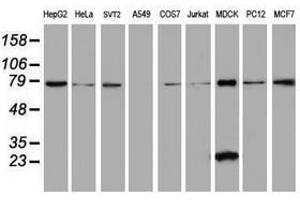 Image no. 2 for anti-Chromosome 21 Open Reading Frame 56 (C21orf56) antibody (ABIN1497041) (C21ORF56 antibody)