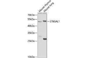 Western blot analysis of extracts of various cell lines, using ST6G antibody (ABIN6130083, ABIN6148536, ABIN6148538 and ABIN6221427) at 1:1000 dilution. (ST6GAL1 antibody  (AA 27-200))