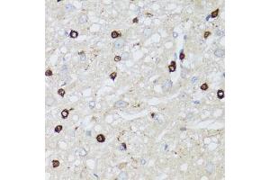 Immunohistochemistry of paraffin-embedded rat brain using MIP antibody (ABIN5971491) at dilution of 1/100 (40x lens). (MIP antibody)