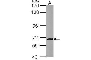 WB Image Sample (30 ug of whole cell lysate) A: JurKat 7. (Phosphoglucomutase 3 antibody)