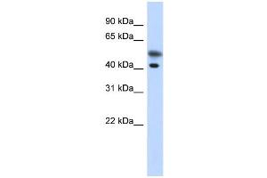 WB Suggested Anti-TMOD2 Antibody Titration: 0. (TMOD2 antibody  (N-Term))