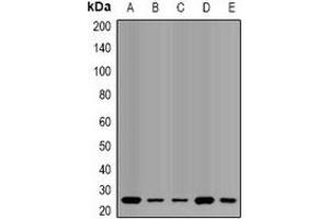 Western blot analysis of QDPR expression in HL60 (A), SW620 (B), mouse liver (C), mouse brain (D), rat liver (E) whole cell lysates. (QDPR antibody)