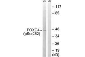 Western blot analysis of extracts from Jurkat cells treated with starved 24h, using FOXO4 (Phospho-Ser262) Antibody. (FOXO4 antibody  (pSer262))