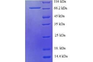 HARS2 Protein (AA 34-506) (His-SUMO Tag)