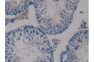 Detection of PAOX in Mouse Testis Tissue using Polyclonal Antibody to Polyamine Oxidase (PAOX) (PAOX antibody  (AA 130-356))