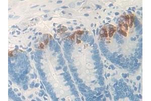 Detection of GIF in Rat Small intestine Tissue using Polyclonal Antibody to Gastric Intrinsic Factor (GIF) (Intrinsic Factor antibody  (AA 196-414))