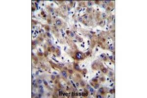 SLC25A6 Antibody immunohistochemistry analysis in formalin fixed and paraffin embedded human liver tissue followed by peroxidase conjugation of the secondary antibody and DAB staining. (SLC25A6 antibody  (AA 128-155))