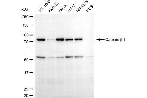 Western blotting analysis using catenin beta 1 antibody (ABIN7797929). (CTNNB1 antibody)