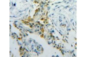 Used in DAB staining on fromalin fixed paraffin-embedded lung tissue (FABP5 antibody  (AA 1-135))