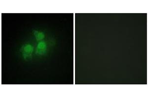 Immunofluorescence analysis of HepG2 cells, using IPPK antibody.