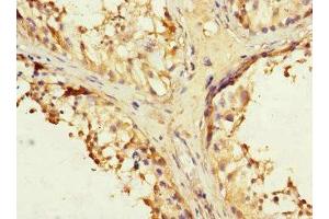 Immunohistochemistry analysis of paraffin-embedded human testis tissue using IFNLR1 antibody at a dilution of 1/100. (IL28RA antibody  (AA 21-228))
