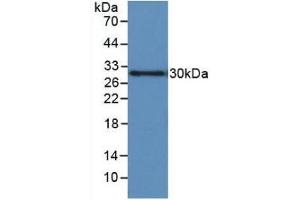 Detection of Recombinant IGFBP1, Human using Monoclonal Antibody to Insulin Like Growth Factor Binding Protein 1 (IGFBP1) (IGFBPI antibody  (AA 36-235))
