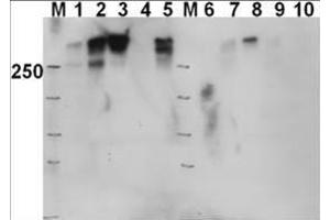 Western blot using  Affinity Purified anti-DNAPKcs antibody shows detection of a 460 kDa band corresponding to human DNAPKcs in various preparations. (PRKDC antibody  (pThr2609))