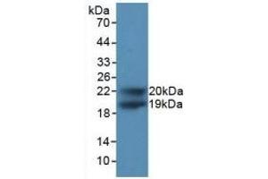 Detection of Recombinant CDKN1A, Human using Polyclonal Antibody to Cyclin Dependent Kinase Inhibitor 1A (CDKN1A) (p21 antibody  (AA 1-164))