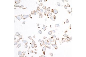 Immunocytochemistry (ICC) image for anti-Cadherin 2 (CDH2) (AA 160-724) antibody (ABIN7453333)