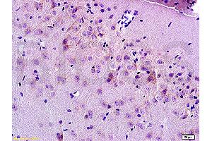 Formalin-fixed and paraffin embedded rat brain tissue labeled Anti-MRP1 Polyclonal Antibody, Unconjugated (ABIN671526) at 1:200, followed by conjugation to the secondary antibody and DAB staining (MRP1 antibody  (AA 501-600))