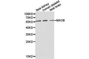 Western Blotting (WB) image for anti-Monoamine Oxidase B (MAOB) antibody (ABIN1873594) (Monoamine Oxidase B antibody)
