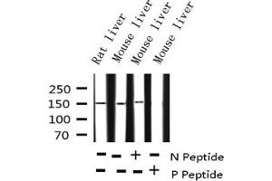 Western Blotting (WB) image for anti-Epidermal Growth Factor Receptor (EGFR) (pSer1071) antibody (ABIN6256098)