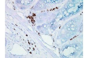 Immunohistochemistry analysis using Mouse Anti-Hsp70 Monoclonal Antibody, Clone BB70 .