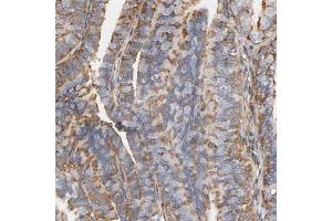 Immunohistochemical staining (Formalin-fixed paraffin-embedded sections) of human fallopian tube shows moderate cytoplasmic positivity in glandular cells. (IFITM3 antibody  (AA 1-57))