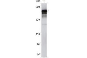Western blot analysis using PDGFRβ mouse mAb against NIH/3T3 cell lysate (1). (PDGFRB antibody)