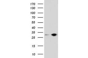 Western Blotting (WB) image for anti-Sepiapterin Reductase (SPR) antibody (ABIN1501114) (SPR antibody)