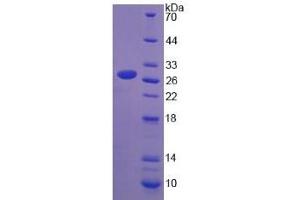 Image no. 1 for Lymphocyte Cytosolic Protein 1 (LCP1) (AA 5-233) protein (His tag) (ABIN4989354)