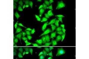 Immunofluorescence analysis of HeLa cells using PPM1A Polyclonal Antibody