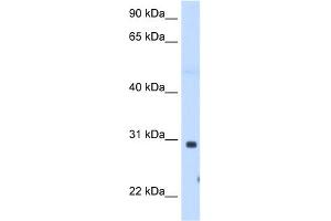 WB Suggested Anti-ST3GAL3 Antibody Titration:  1. (ST3GAL3 antibody  (C-Term))