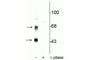 Western blot of rat brain lysate showing specific immunolabeling of the ~50 kDa α- and the ~60 kDa β-CaM Kinase II phosphorylated at Thr306 in the first lane (-). (CaMKII alpha/beta (pThr306) antibody)