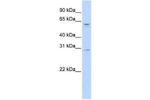 Western Blotting (WB) image for anti-REC8 Homolog (Yeast) (REC8) antibody (ABIN2459159) (REC8 antibody)