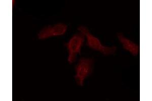 ABIN6274488 staining COLO205 by IF/ICC. (ATF6B antibody  (Internal Region))