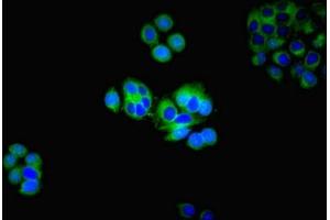 Immunofluorescent analysis of PC-3 cells using ABIN7142622 at dilution of 1:100 and Alexa Fluor 488-congugated AffiniPure Goat Anti-Rabbit IgG(H+L) (HTR2A antibody  (AA 385-471))