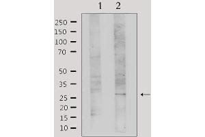 Western blot analysis of extracts from Hela, using Galectin 3 Antibody. (Galectin 3 antibody  (Internal Region))
